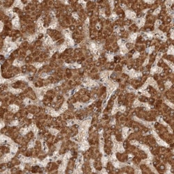 SWT1 Antibody, Novus Biologicals 0.1mL; Unlabeled:Antikörper